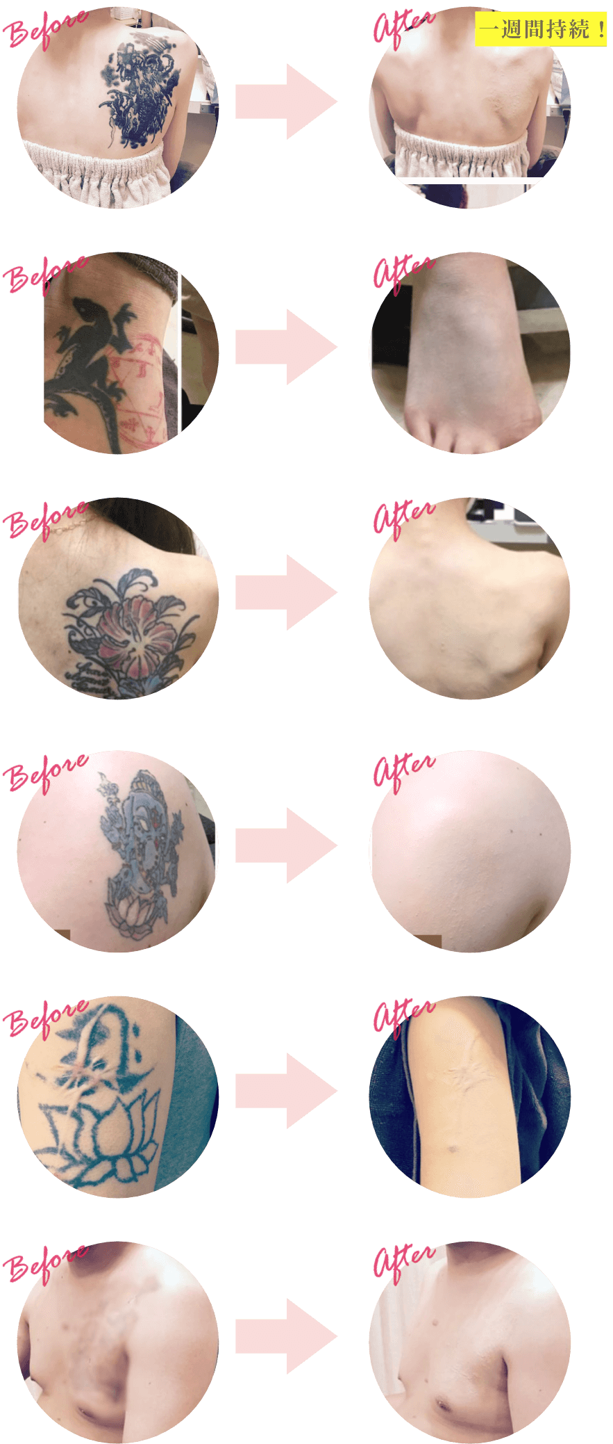 before and after